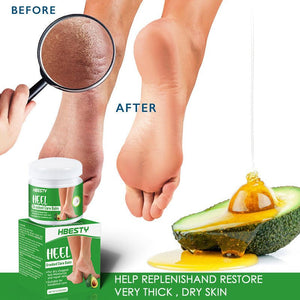 Avocado Heel Cracking Cream - Yahko Merchandise