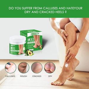 Avocado Heel Cracking Cream - Yahko Merchandise