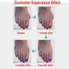 Bunion Corrector Silicone Toe Sleeves and Separator - Yahko Merchandise