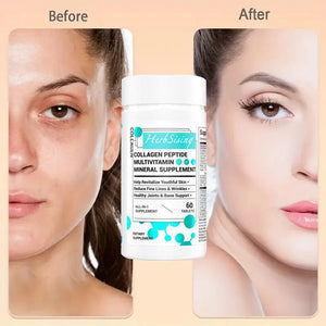 Collagen Peptides For Women, Beauty Vitamin And Mineral Supplement With Multivitamins, Hydrolyzed Protein Peptide Type, Biotin And Vitamins - 60 Capsules - Yahko Merchandise
