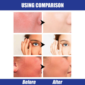 Lightweight Freshing And Moistrurizing Waterproof SPF50 Hyaluronic Acid Sun Block Stick - Yahko Merchandise