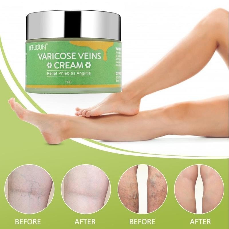 Vein Cream Red Blood Streaks Repair Earthworm Leg Bruises Bulge Relief Pain Safflower Skin care lotion Varicose Cream - Yahko Merchandise